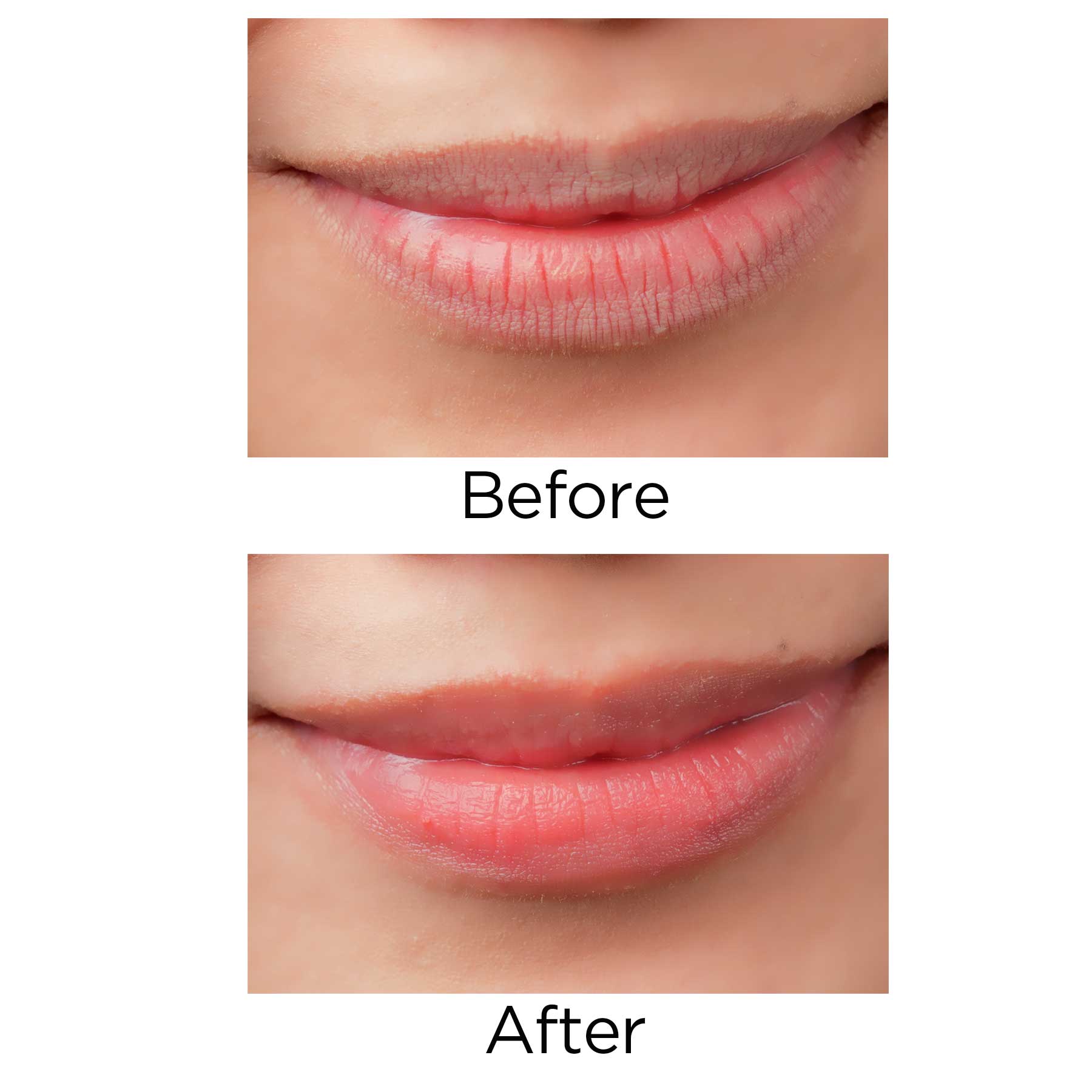 Lip Scrub Before And After